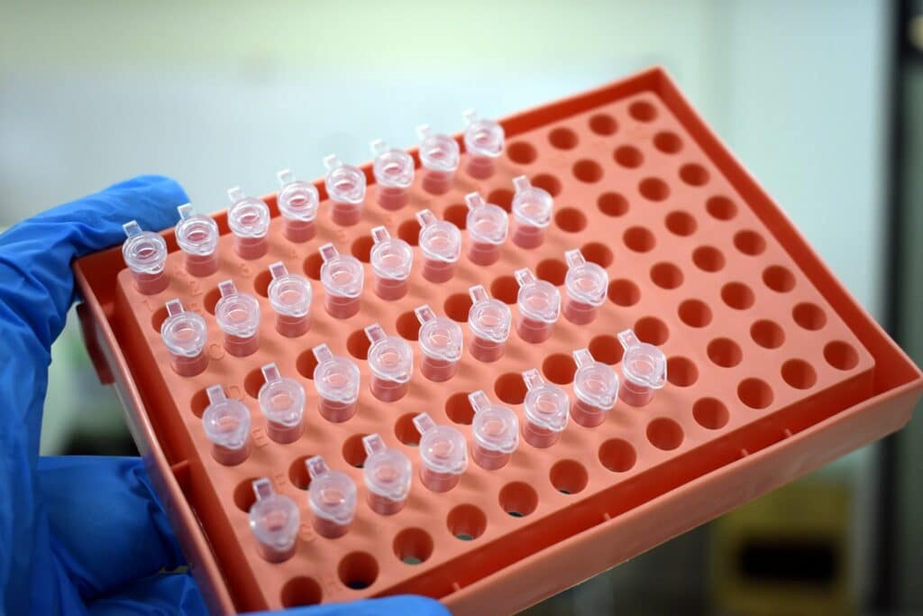 image of blood samples